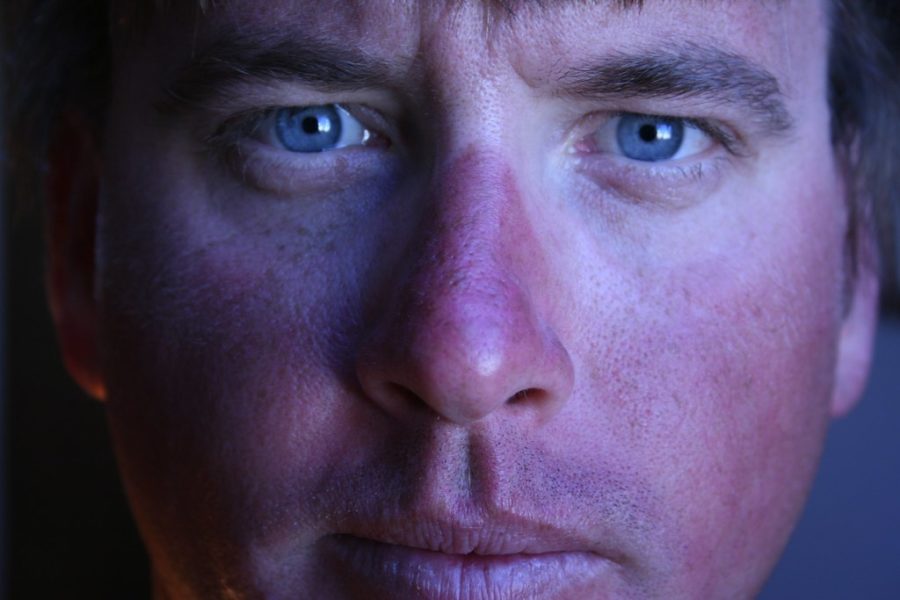 Five Ways to Treat Sunburns (Health and Wellness)