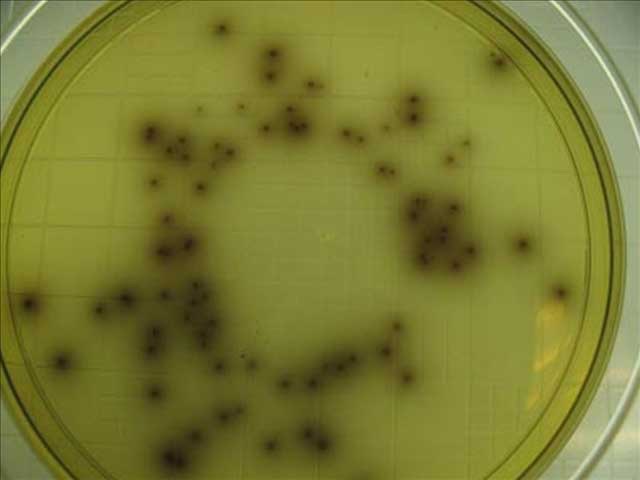 Sample of Listeria bacteria (Creative Çommons)